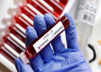 ਲਾਸ ਏਂਜਲਸ ਨੇ ਪਾਰ ਕੀਤਾ ਕੋਰੋਨਾ ਵਾਇਰਸ ਦੇ ਪੁਸ਼ਟੀ ਕੀਤੇ ਹੋਏ 1 ਮਿਲੀਅਨ ਕੇਸਾਂ ਦਾ ਅੰਕੜਾ